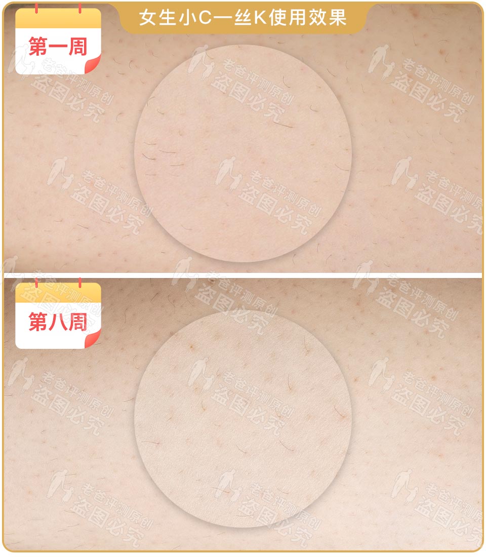 最真实的脱毛仪,bequeen脱毛仪实测