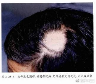 自我剖析问题原因和整改措施,自我诊断原因分析及改进措施