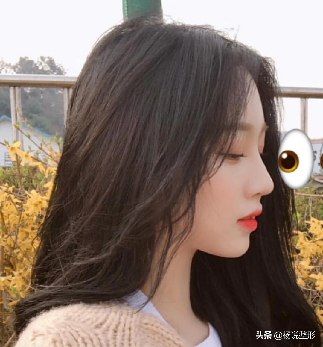 六种常见的失败隆鼻手术,隆鼻怎么预防鼻头越来越尖