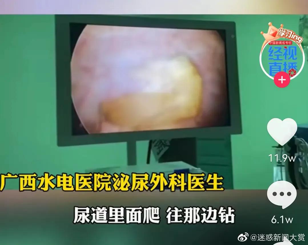 “​男子将活虾塞入尿道，结果小虾游进膀胱……”