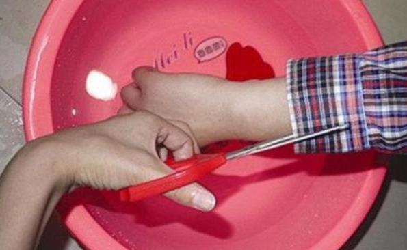 小孩不小心把手伸进煤气灶烫到了,开水烫伤婴儿手怎么处理