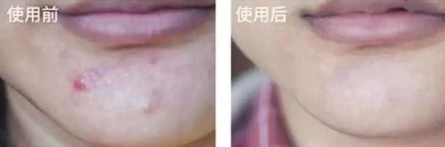 农科院研发的纯植物护肤品,农科院研究的护肤品