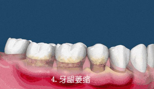 牙科诊所里你不知道的事,口腔医生提醒