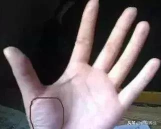 手上这块肉能看出你的身体好坏,手掌根部有肉的人是不是头脑笨