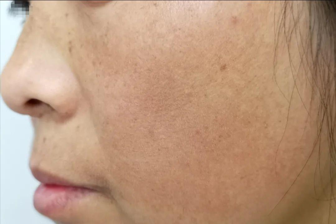 让你悄悄变美的4个小细节,让你偷偷变美的三种药膏