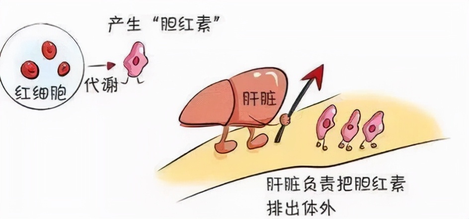 阻塞性黄疸怎么保守治疗,阻塞性黄疸凝血功能下降