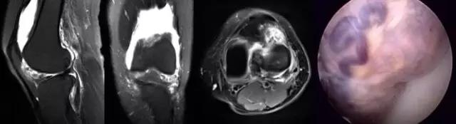 mri临床医师必读电子书,临床医生如何读mri