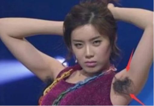 腋下一边长毛一边没长这是为什么,女性腋下一直没有长毛是什么原因