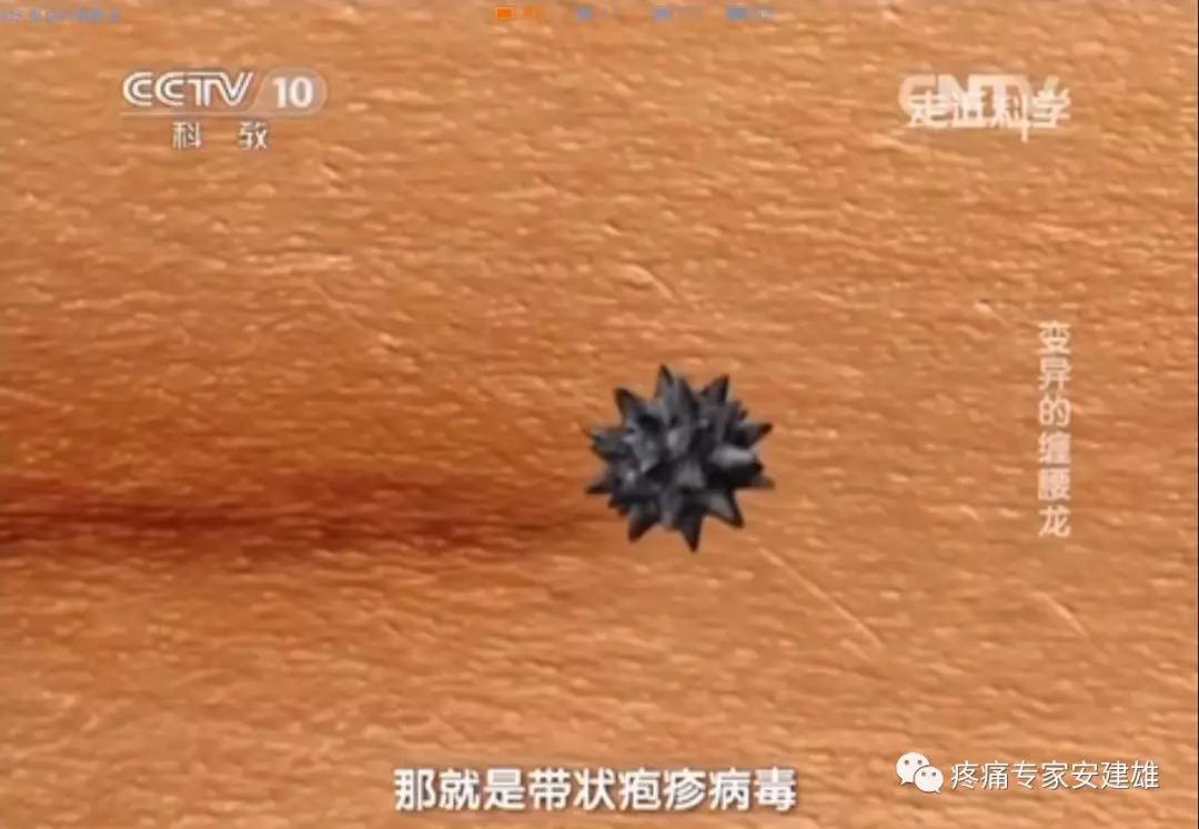 听说这种病，缠满身体一圈会死人？