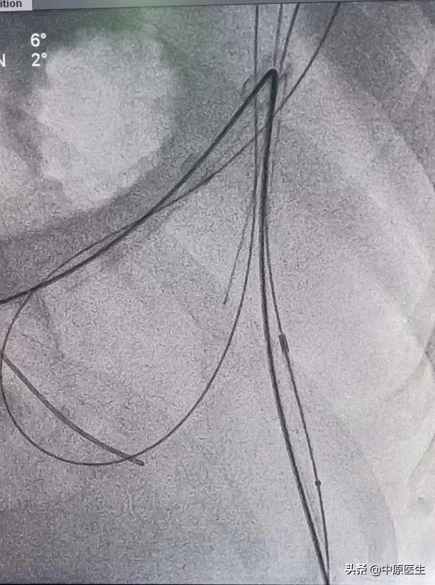 手术室没想象中的那么可怕,手术室没有想象的那么可怕