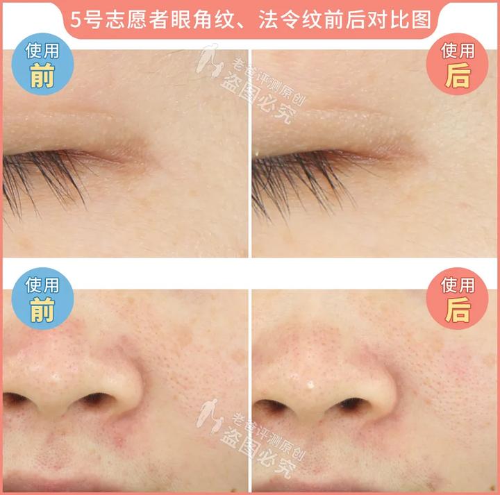 测评家用美容仪真的有用吗,网红推荐的美容仪有用吗