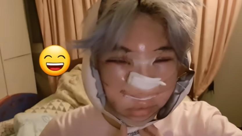 韩国明星男整容对比,韩国男明星整容疑似失败