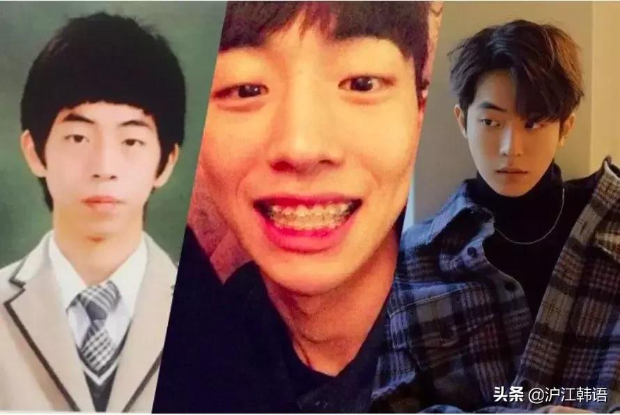 女明星矫正牙齿前后对比,明星牙齿矫正前后对比图