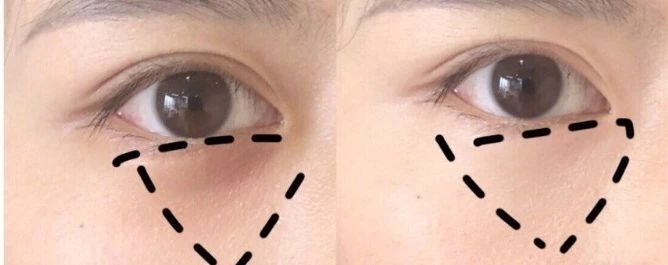 张馨予用的是什么眼霜,张馨予美致颜眼部精华乳