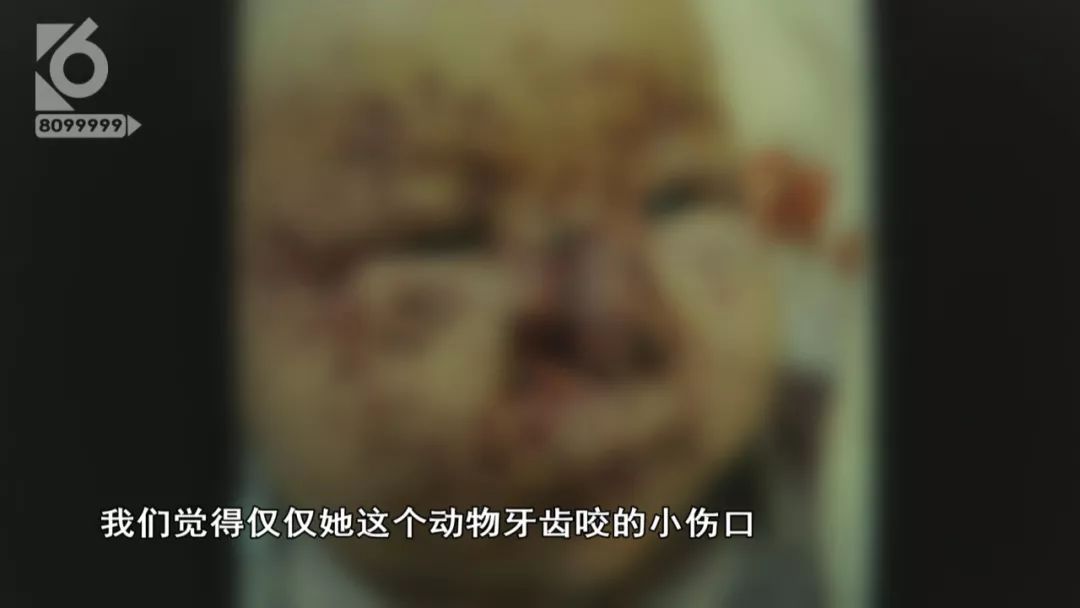 老鼠啃三个月婴儿事件,婴儿熟睡时被老鼠啃食新闻