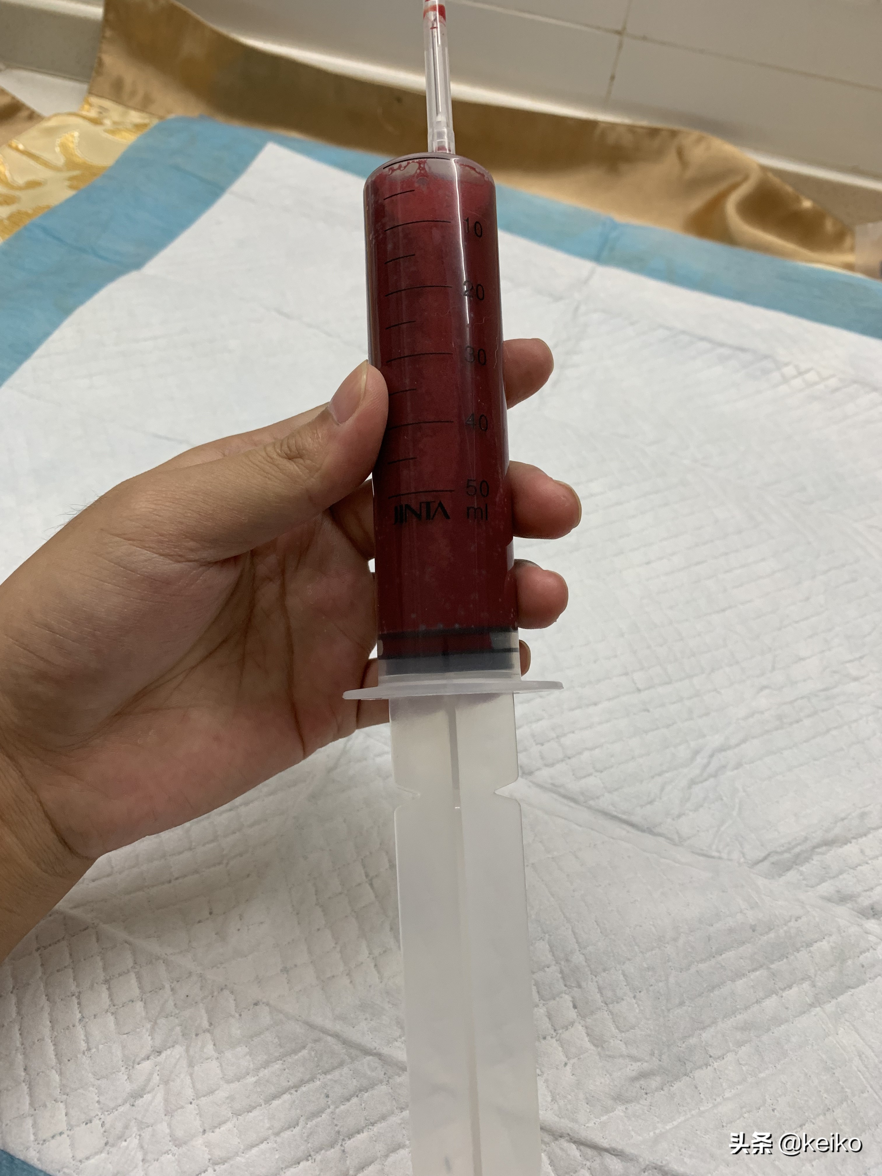 巴贝斯寄生虫治疗多久,巴贝斯寄生虫会传染人吗