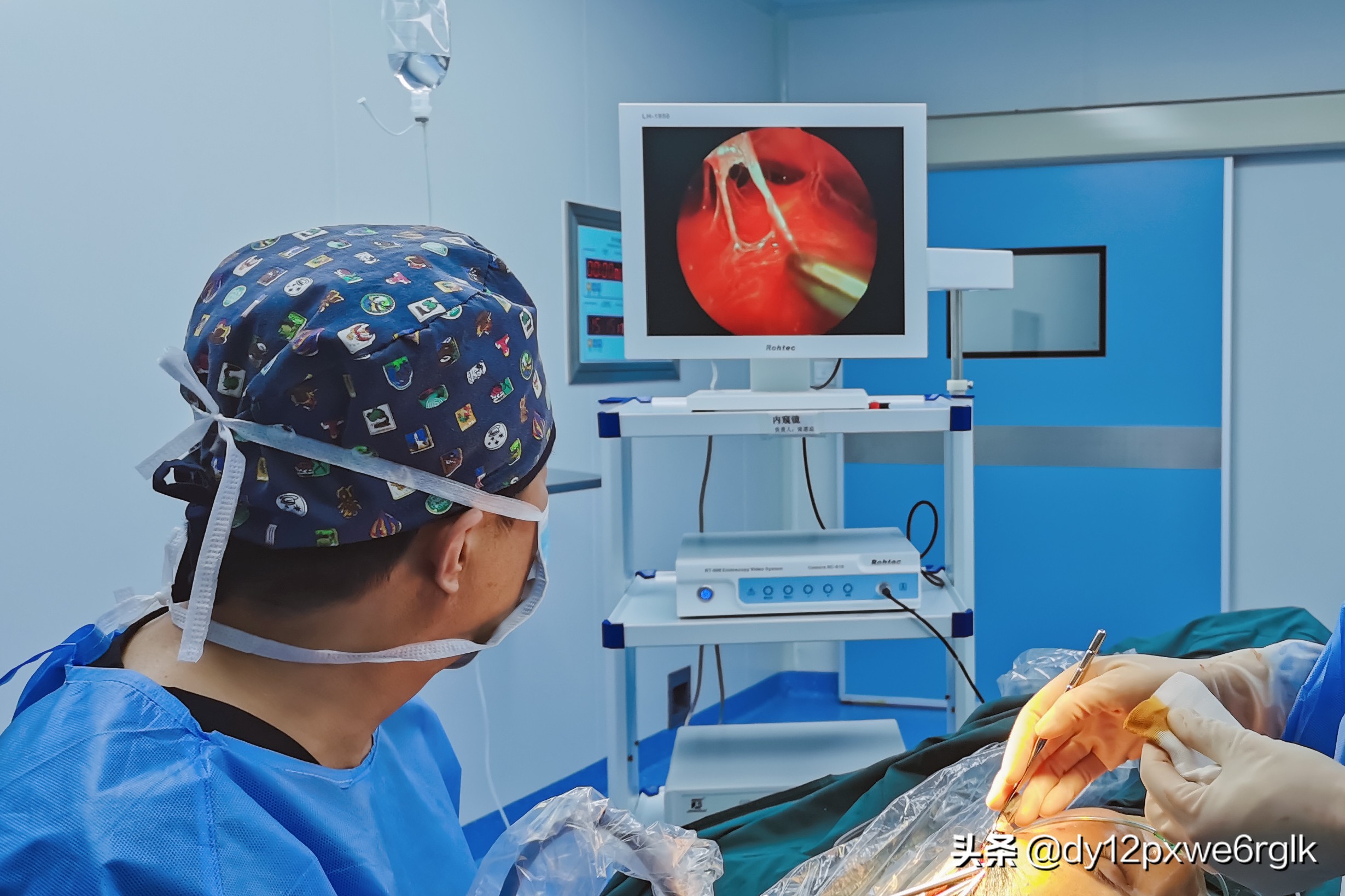 拉皮术除皱是怎么做的,拉皮除皱术怎么样有啥副作用吗