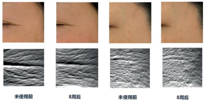 虾青素真的可以抗氧化吗,虾青素抗氧成功