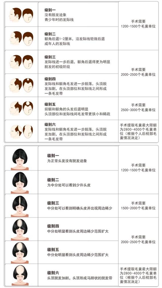 2.5亿脱发人口造就百亿植发生意，不过，动刀的可能是3天速成医师