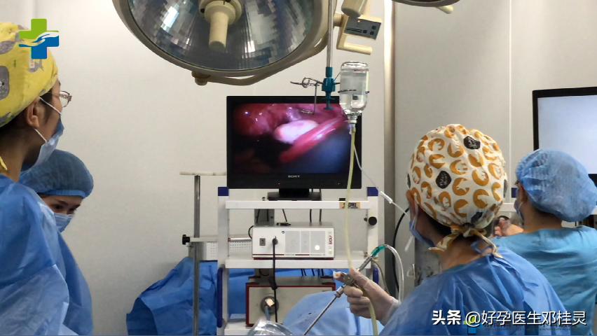 输卵管造影有无痛不插管的吗,检查输卵管通畅有必要查宫腔镜吗