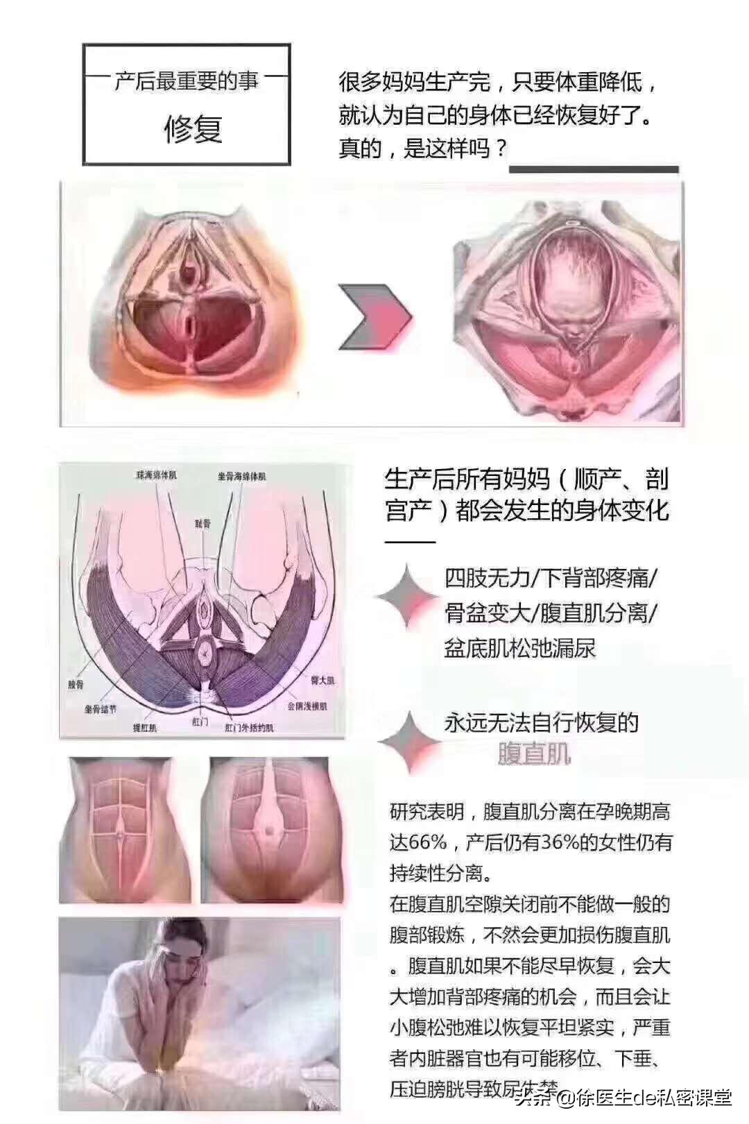 普拉提环产后修复,梵一瑜伽普拉提产后修复私教