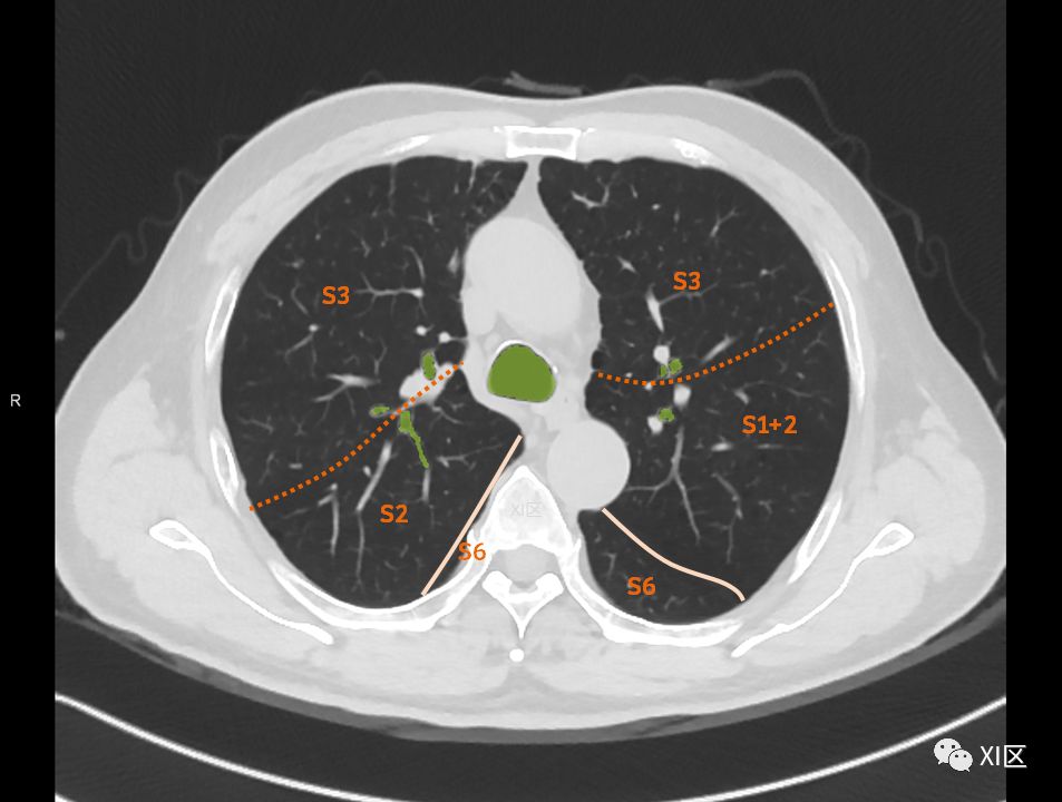 如此详细的肺部影像解剖，有点儿酷！