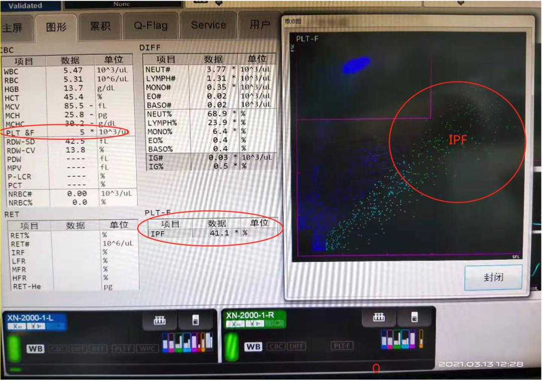 是谁揭开了血小板减少的面纱?
