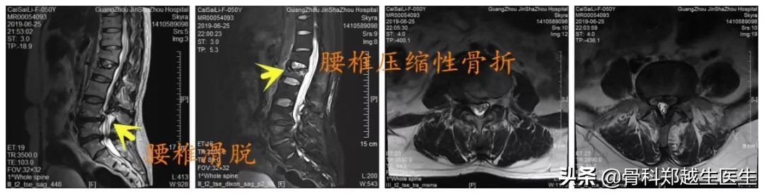 腰椎、颈椎疼痛，能不能推拿按摩治疗？骨科医生提出了这样的意见