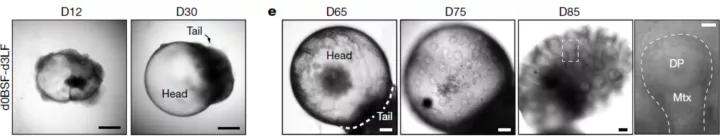 脱发治愈研究,困扰当代年轻人的脱发