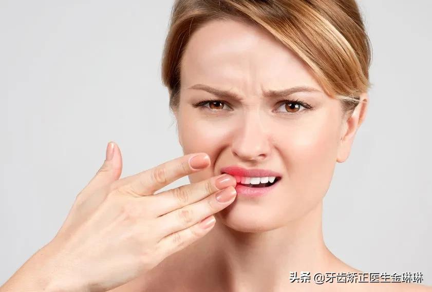 牙龈肿痛牙龈出血是否是病,为什么一上火牙龈就出血