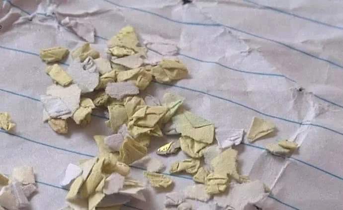 眼内有异物感是什么原因,医院如何取出眼内异物