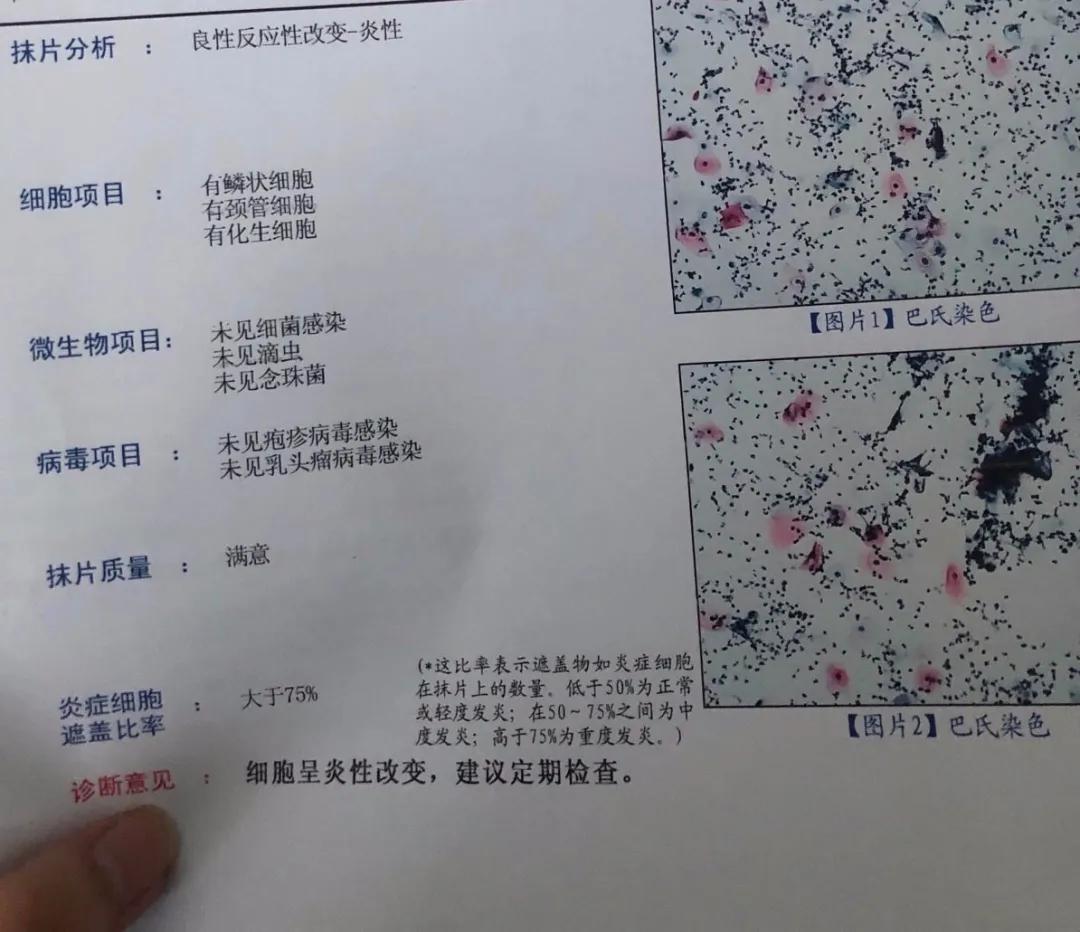 女孩第一次做妇科检查,女性第一次做妇科检查注意事项