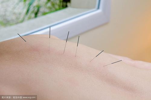 中医治疗强直性脊柱炎有治愈的吗,中医治强直性脊柱炎有什么好方案