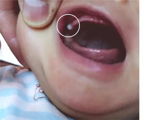 家有小宝贝，这几种特殊的生理现象不是病，家长不用太着急