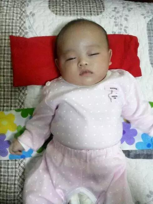 青蛙胀气,怎么看一个月宝宝肚子鼓鼓的胀气