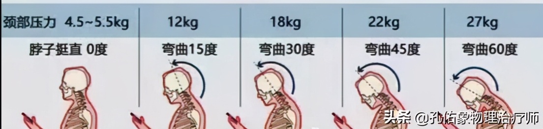 颈椎间盘突出手指尖麻乏力怎么治,颈椎间盘突出导致四肢无力疼痛