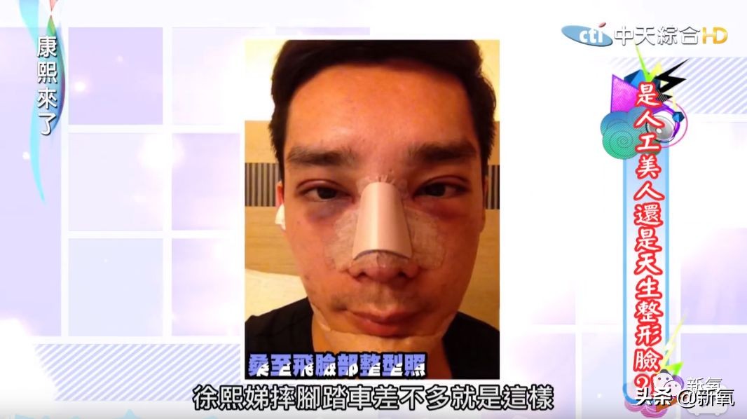 花90万从头整到脚，还可以这么自然？旁边纯天然小姐姐都看懵了