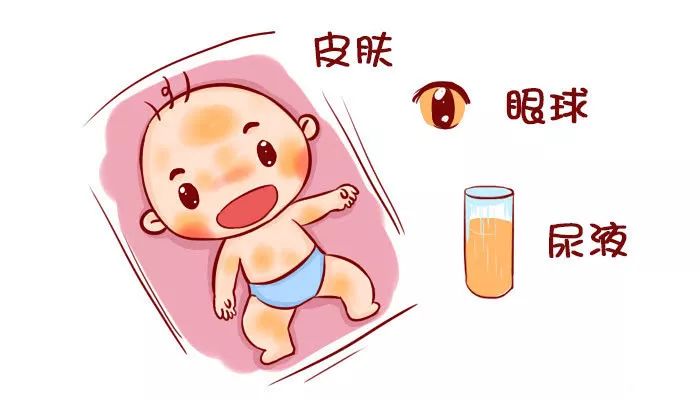 小孩子黄疸可以通过晒太阳治疗吗？