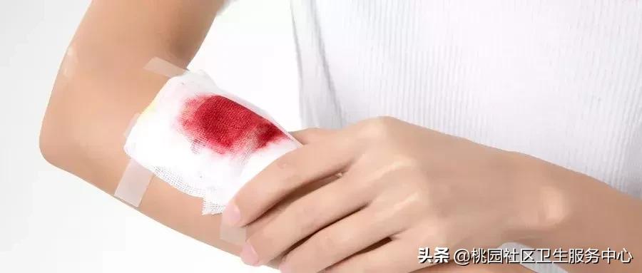 手被锈钉子划伤了需要打破伤风么,孩子手划伤了需要打破伤风针吗