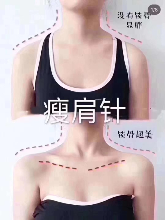 注射肉毒素瘦肩后注意什么,注射肉毒素真的可以瘦肩不