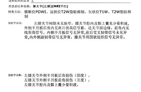 膝关节核磁共振报告单上怎么看,膝关节核磁正常报告单