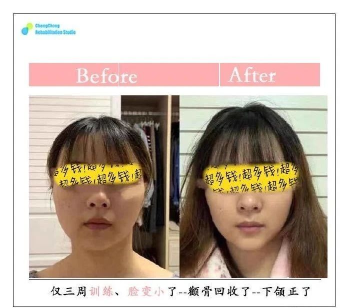 下巴怎么样才能越来越好看,怎么样才能让下巴变得好看