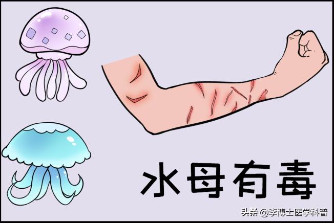 被水母蛰伤后处理视频英文,被水母蜇科普动画