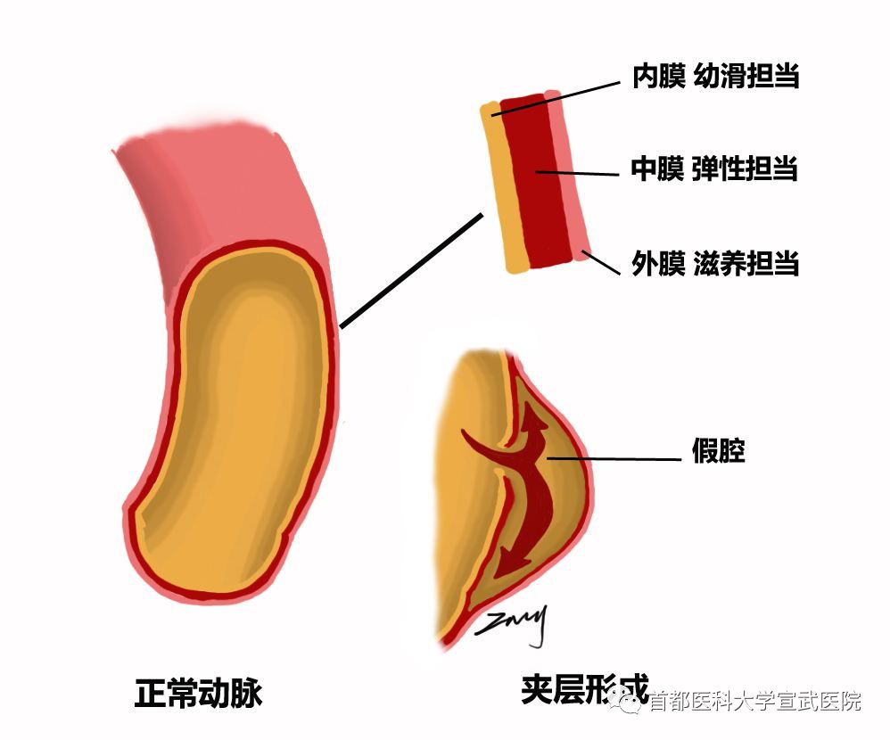 宣医科普｜“夺命”瑜伽让网红住进ICU，运动其实也有雷区