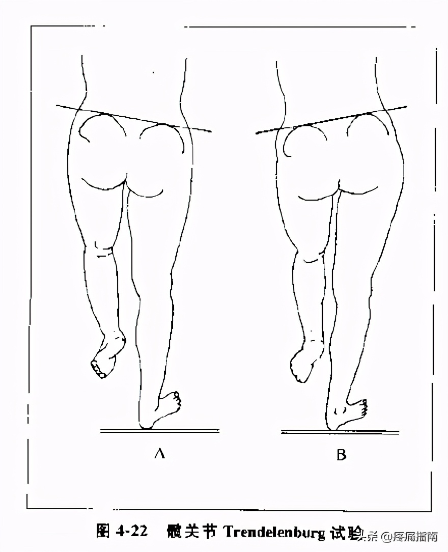 夏天无注射液能治疗骨头坏死吗,骨头坏死用针刀镜有用么