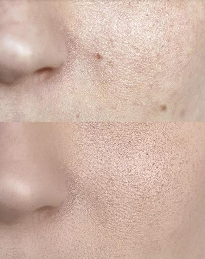 如何美化皮肤好看,皮肤高级美化修饰