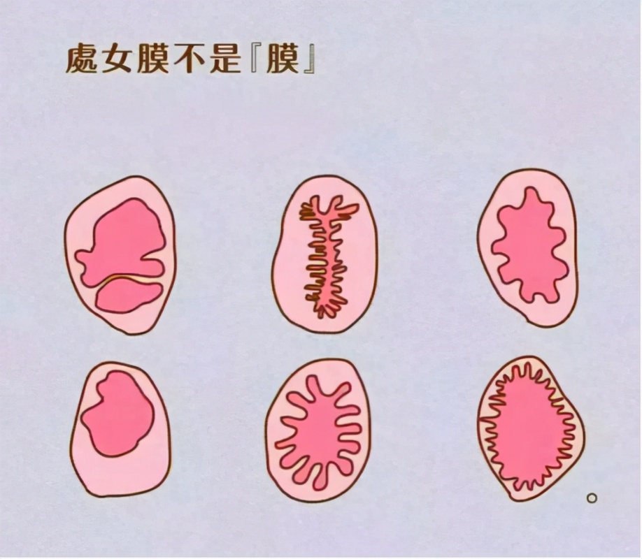 处女膜,其实并不是膜