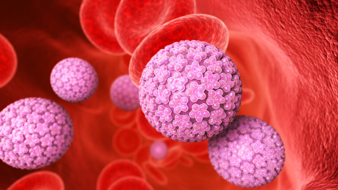 有hpv感染最怕做这几件事,身体发出4个信号证明你感染了hpv