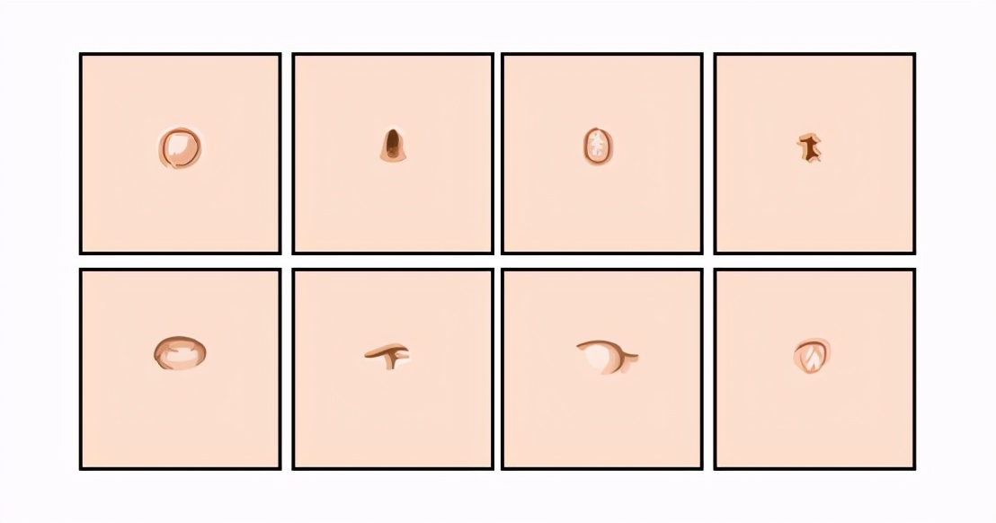 肚脐眼长得难看怎么办,肚脐眼很难看能做手术吗