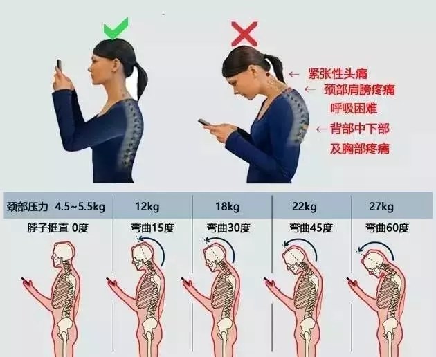 什么是脊椎病呢,颈椎病最严重的是哪种